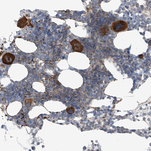 Immunohistochemical staining of human bone marrow shows strong cytoplasmic positivity in megakaryocytes.