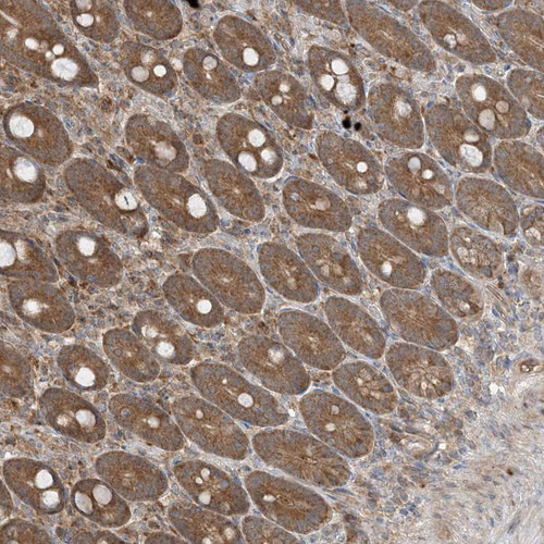 Immunohistochemical staining of human duodenum shows moderate granular cytoplasmic positivity in glandular cells.