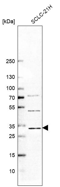 Western blot analysis in human cell line SCLC-21H.