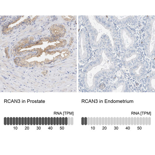 Immunohistochemistry analysis in human prostate and endometrium tissues using Anti-RCAN3 antibody. Corresponding RCAN3 RNA-seq data are presented for the same tissues.