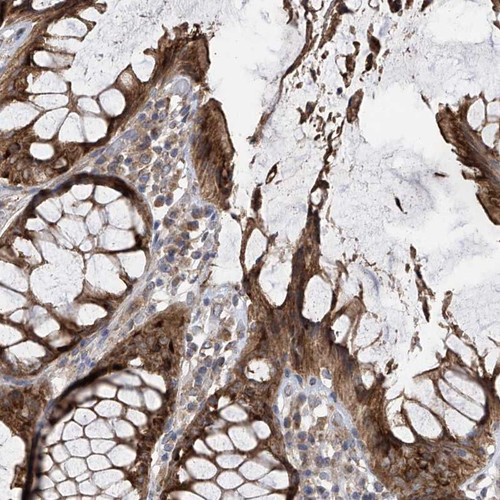 Immunohistochemical staining of human rectum shows strong cytoplasmic positivity with a granular pattern in glandular cells.