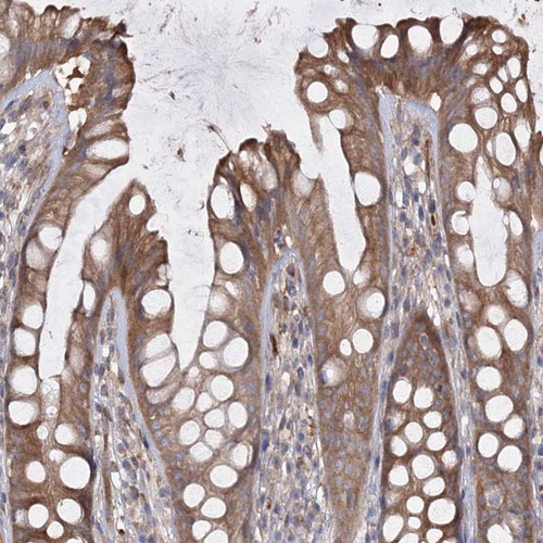 Immunohistochemical staining of human rectum shows moderate cytoplasmic positivity in glandular cells.