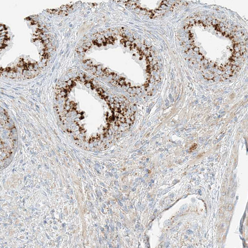 Immunohistochemical staining of human prostate shows strong granular cytoplasmic positivity in glandular cells.