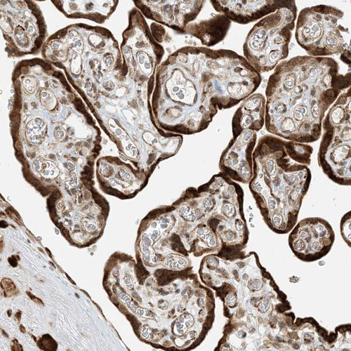 Immunohistochemical staining of human placenta shows strong cytoplasmic positivity in trophoblastic cells.