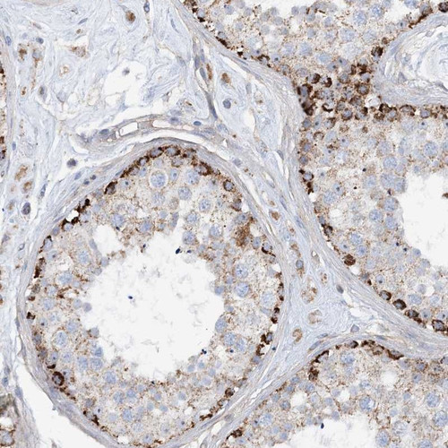 Immunohistochemical staining of human testis shows strong cytoplasmic positivity in cells in seminiferus ducts.