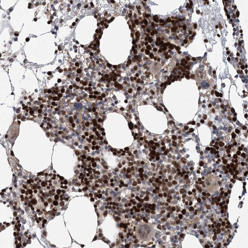 Immunohistochemical staining of human bone marrow shows strong nuclear positivity in hematopoietic cells.