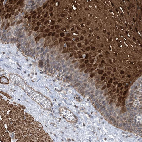 Immunohistochemical staining of human esophagus shows strong nuclear and cytoplasmic positivity in superficial cells of squamous epithelia.