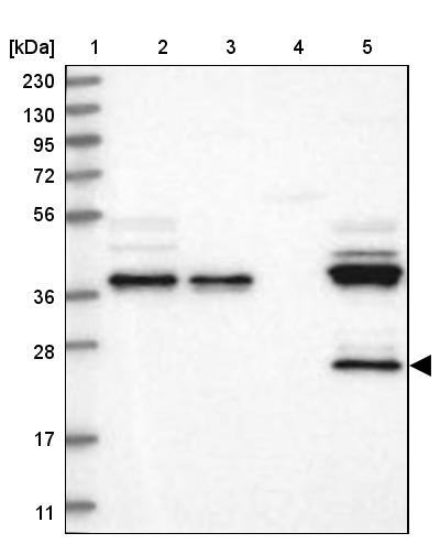Lane 1: Marker [kDa] 230, 130, 95, 72, 56, 36, 28, 17, 11<br/>Lane 2: Human cell line RT-4<br/>Lane 3: Human cell line U-251MG sp<br/>Lane 4: Human plasma (IgG/HSA depleted)<br/>Lane 5: Human liver tissue