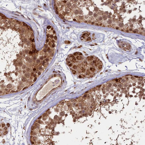 Immunohistochemical staining of human testis shows cytoplasmic and nuclear positivity in cells in seminiferous ducts and Leydig cells.