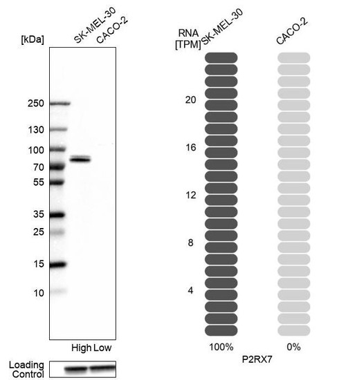 Western blot analysis in human cell lines SK-MEL-30 and Caco-2 using Anti-P2RX7 antibody. Corresponding P2RX7 RNA-seq data are presented for the same cell lines. Loading control: Anti-GAPDH.