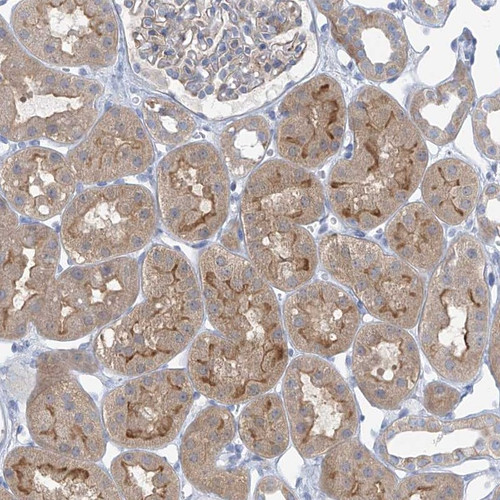 Immunohistochemical staining of human kidney shows moderate cytoplasmic and luminal membranous positivity in cells in tubules.