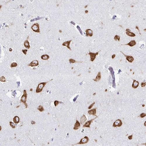 Immunohistochemical staining of human caudate shows strong cytoplasmic positivity in neuronal cells.
