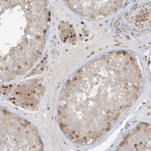 Immunohistochemical staining of human testis shows strong nuclear and cytoplasmic positivity in Leydig cells.