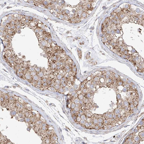 Immunohistochemical staining of human testis shows strong cytoplasmic positivity in cells of seminiferus ducts.