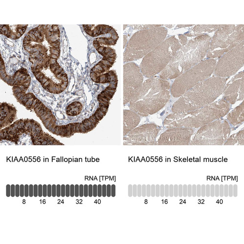 Immunohistochemistry analysis in human fallopian tube and skeletal muscle tissues using Anti-KIAA0556 antibody. Corresponding KIAA0556 RNA-seq data are presented for the same tissues.