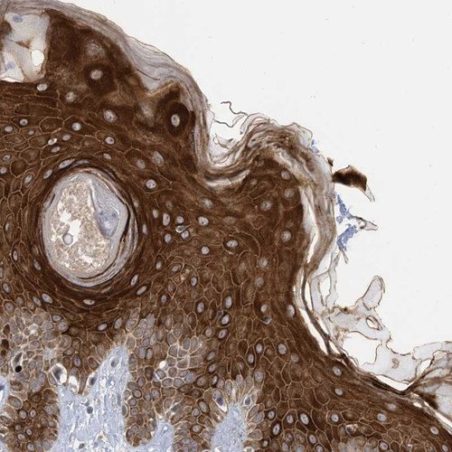 Immunohistochemical staining of human skin shows strong cytoplasmic positivity in epidermal cells.
