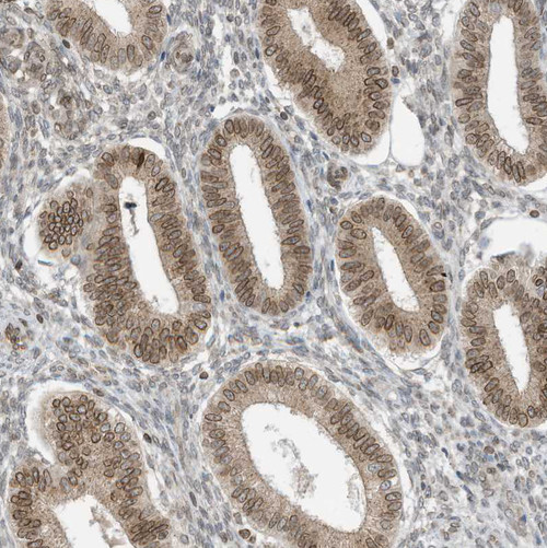 Immunohistochemical staining of human endometrium shows moderate positivity in nuclear membrane in glandular cells.