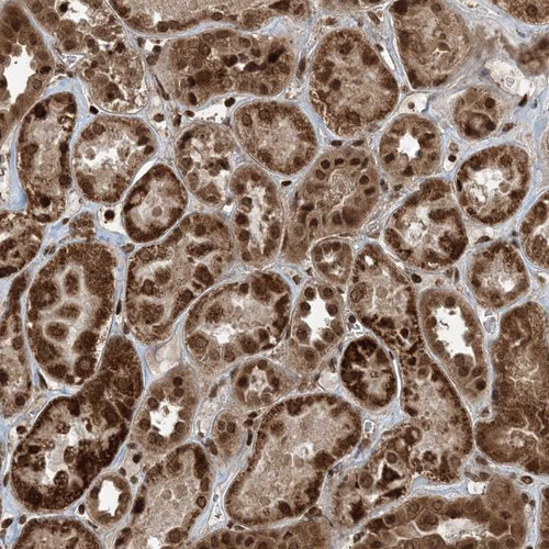 Immunohistochemical staining of human kidney shows strong cytoplasmic and nuclear positivity in cells in tubules.
