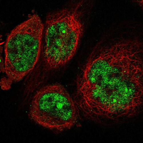 Immunofluorescent staining of human cell line A-431 shows localization to nucleoplasm & nuclear bodies.