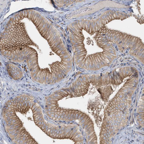 Immunohistochemical staining of human gallbladder shows moderate membranous and cytoplasmic positivity in glandular cells.