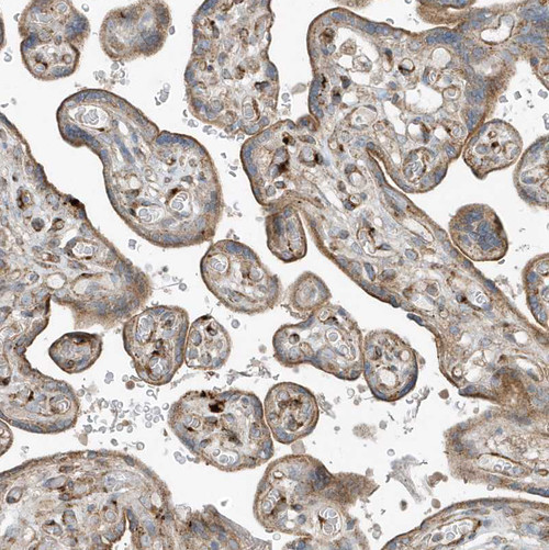 Immunohistochemical staining of human placenta shows moderate cytoplasmic and membranous positivity in trophoblastic cells.