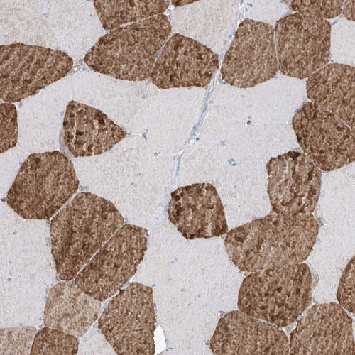 Immunohistochemical staining of human skeletal muscle shows strong cytoplasmic positivity.
