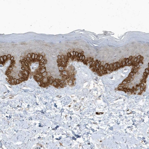 Immunohistochemical staining of human skin shows strong cytoplasmic positivity in basal cells of the squamous epithelium.