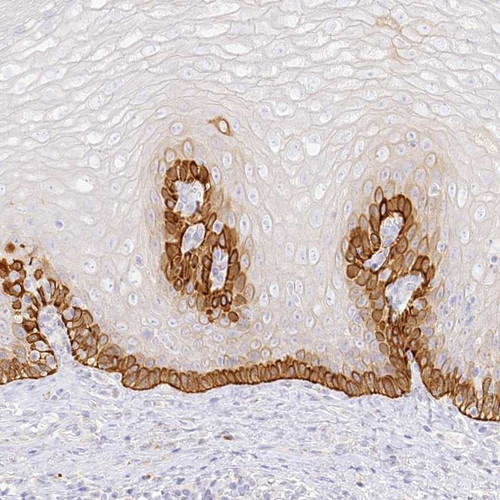 Immunohistochemical staining of human esophagus shows strong cytoplasmic positivity in basal layer of squamous epithelial cells.