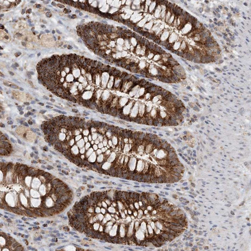 Immunohistochemical staining of human rectum shows strong granular cytoplasmic positivity in glandular cells.