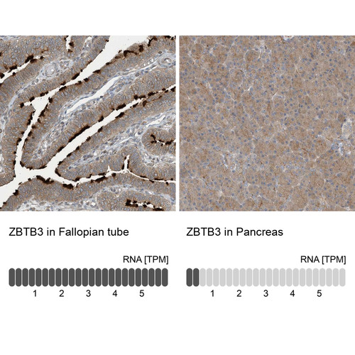 Immunohistochemistry analysis in human fallopian tube and pancreas tissues using Anti-ZBTB3 antibody. Corresponding ZBTB3 RNA-seq data are presented for the same tissues.