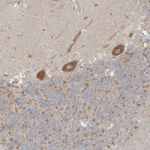 Immunohistochemical staining of human cerebellum shows moderate to strong cytoplasmic positivity in Purkinje cells.