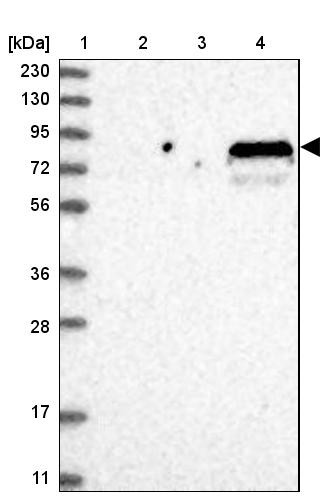 Lane 1: Marker [kDa] 230, 130, 95, 72, 56, 36, 28, 17, 11<br/>Lane 2: Human cell line RT-4<br/>Lane 3: Human cell line U-251MG sp<br/>Lane 4: Human plasma (IgG/HSA depleted)