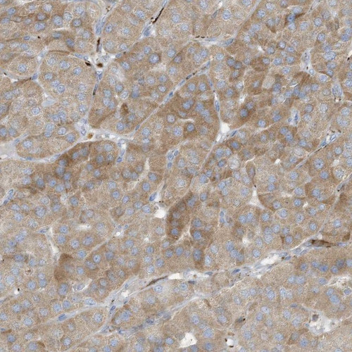 Immunohistochemical staining of human parathyroid gland shows moderate positivity in glandular cells.
