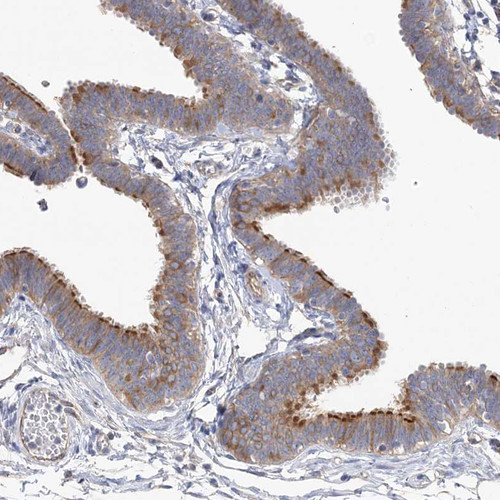Immunohistochemical staining of human fallopian tube shows moderate to strong membranous positivity in glandular cells.