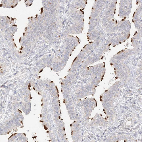 Immunohistochemical staining of human Fallopian tube shows strong positivity in cilia in glandular cells.