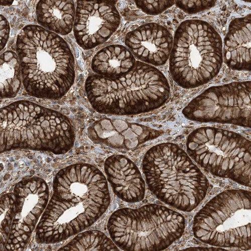 Immunohistochemical staining of human stomach shows strong cytoplasmic and membranous positivity in glandular cells.