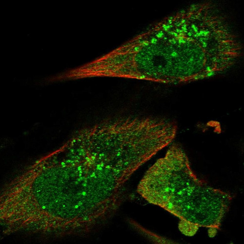 Immunofluorescent staining of human cell line U-251 MG shows localization to nucleoplasm, cytosol & vesicles.