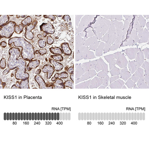 Immunohistochemistry analysis in human placenta and skeletal muscle tissues using HPA035542 antibody. Corresponding KISS1 RNA-seq data are presented for the same tissues.