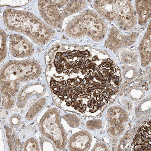 Immunohistochemical staining of human kidney shows strong membranous positivity in cells in glomeruli.