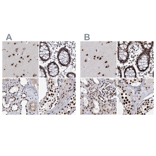 Immunohistochemical staining of human cerebral cortex, colon, kidney and testis using Anti-SCAF8 antibody HPA035601 (A) shows similar protein distribution across tissues to independent antibody HPA035602 (B).