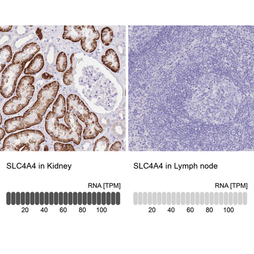 Immunohistochemistry analysis in human kidney and lymph node tissues using HPA035628 antibody. Corresponding SLC4A4 RNA-seq data are presented for the same tissues.