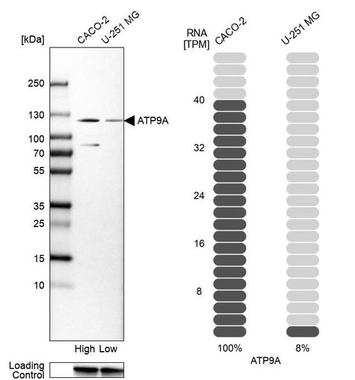 Western blot analysis in human cell lines Caco-2 and U-251MG using Anti-ATP9A antibody. Corresponding ATP9A RNA-seq data are presented for the same cell lines. Loading control: Anti-GAPDH.