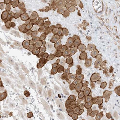 Immunohistochemical staining of human placenta shows distinct membranous and cytoplasmic positivity in decidual cells.