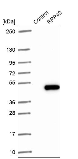 Western blot analysis in control (vector only transfected HEK293T lysate) and RPP40 over-expression lysate (Co-expressed with a C-terminal myc-DDK tag (~3.1 kDa) in mammalian HEK293T cells, LY416512).