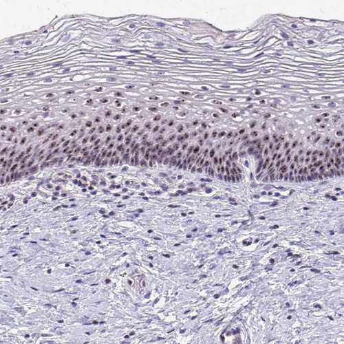 Immunohistochemical staining of human cervix shows strong nucleolar positivity in squamous epithelial cells.