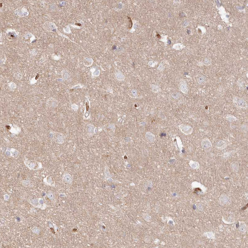 Immunohistochemical staining of human cerebral cortex shows moderate cytoplasmic positivity in neurons.