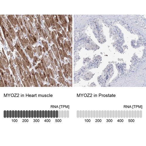 Immunohistochemistry analysis in human heart muscle and prostate tissues using Anti-MYOZ2 antibody. Corresponding MYOZ2 RNA-seq data are presented for the same tissues.