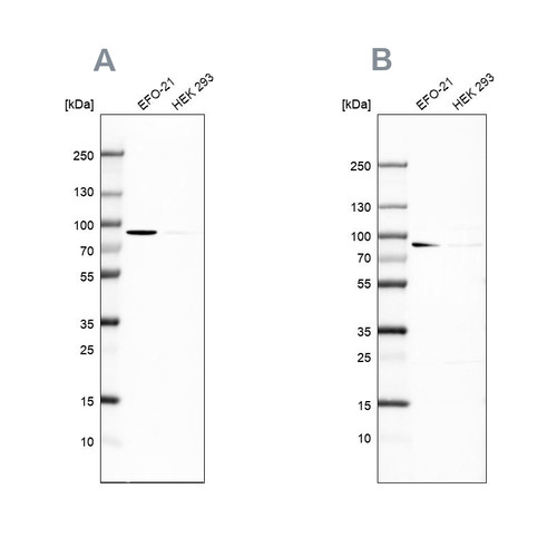 Western blot analysis using Anti-DPP3 antibody HPA035781 (A) shows similar pattern to independent antibody HPA035780 (B).