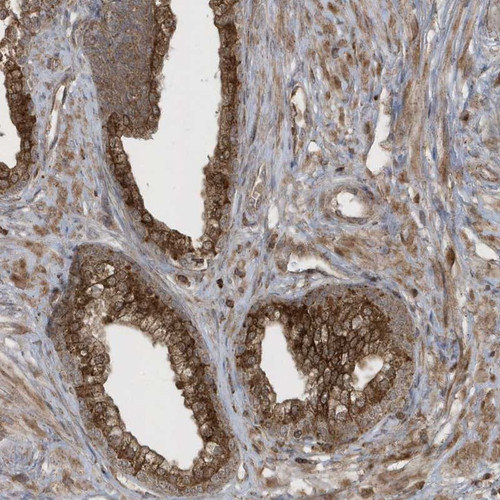 Immunohistochemical staining of human prostate shows strong cytoplasmic positivity in glandular cells.