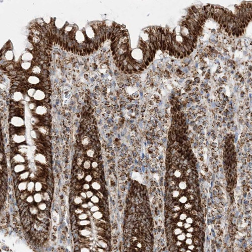 Immunohistochemical staining of human colon shows strong cytoplasmic positivity(granular pattern) in glandular cells.
